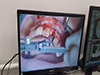 full-screen-iznajmljivanje-audio-i-video-opremen-stomatoloski-fakultet-prenos-operacije-live-2
